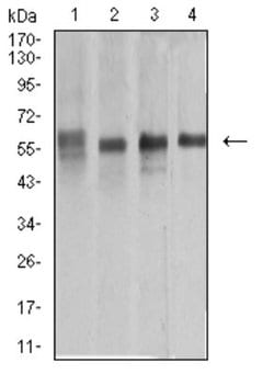 Cytokeratin 10 Antibody (1C3D9) - BSA Free, Novus Biologicals 0.1 ml; Unconjugated:Antibodies,